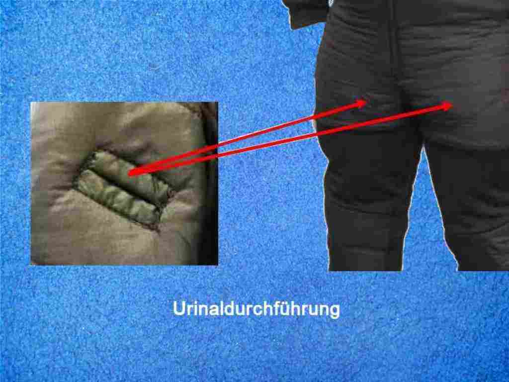 Bigblue Adapter 6 cm mit Kugel – Bild 3